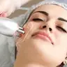Curso Radiofrequência Rosto