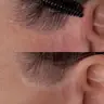 NARBENKASCHIERUNG & AREOLA-PIGMENTIERUNG: PARAMEDIZINISCHE PIGMENTIERUNG
