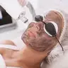 Formação peeling a Carbono