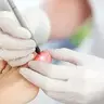 Formação Laser Podologia