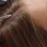 Мезотерапія (шкіра голови): Hair Care
