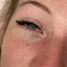 Volume auffüllen Tag 15-21.