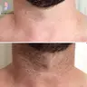 Шия + плечі (Man)