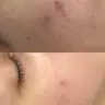 Skin Recovery Ritual