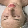 Ферментотерапія