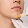 Депіляція підборіддя