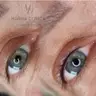 WIMPERNKRANZVERDICHTUNG