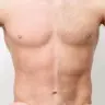 Brust enthaaren
