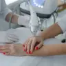 Мікроголковий RF-ліфтинг кистей рук