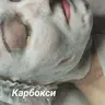 Карбоксітерапія обличчя