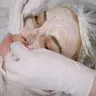 Чистка обличчя атравматична