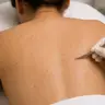 Чистка спини