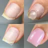 Nagelreparatur
