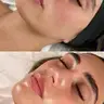 Пілінг Jalupro glow peel