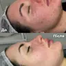 Пілінг Skin Recovery