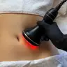 КАВІТАЦІЯ