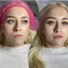 Контурна пластика губ Juvederm ultra smile 0,5ml