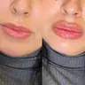 Контурна пластика губ Saypha filler 1ml