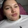Контурна пластика губ Stylage M lido 1ml