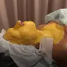 Плазмовий душ обличчя, шиї та декольте