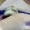 Комбінована чистка обличчя