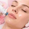 Aquafacial