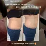 1 зона. Аппаратне схуднення Slim Body + Endo