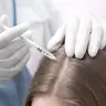 Мезотерапія (шкіра голови): Dr.CYJ hair filler