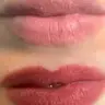 Auffrischung nach 1 Jahr (Lippen)