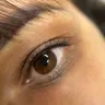 Auffrischung nach 1 Jahr (Wimpernkranzverdichtung)