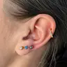 Ohrläppchen (beide Seiten): 60 €