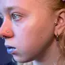 Nasenflügeln/ крило носа