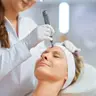 Microneedling des gesichts