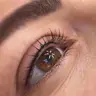 Wimpernkranzverdichtung