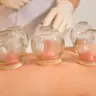 Schröpfmassage (nur Rücken) | 30 Min.