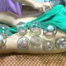 Schröpfmassage (nur Rücken und Beinen.) | 60 Min.