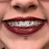 Toothgems