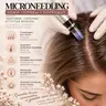 Microneedling: Kopfhaut Микронидлинг: кожа головы