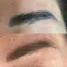 Détatouage au laser: élimination du maquillage permanent et des tatouages