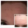 Anti-Aging Behandlung