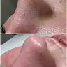 Gesicht Reinigung
