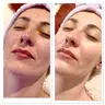 Gesicht Reinigung + Peeling