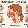 Myofunkční terapie - vstupní