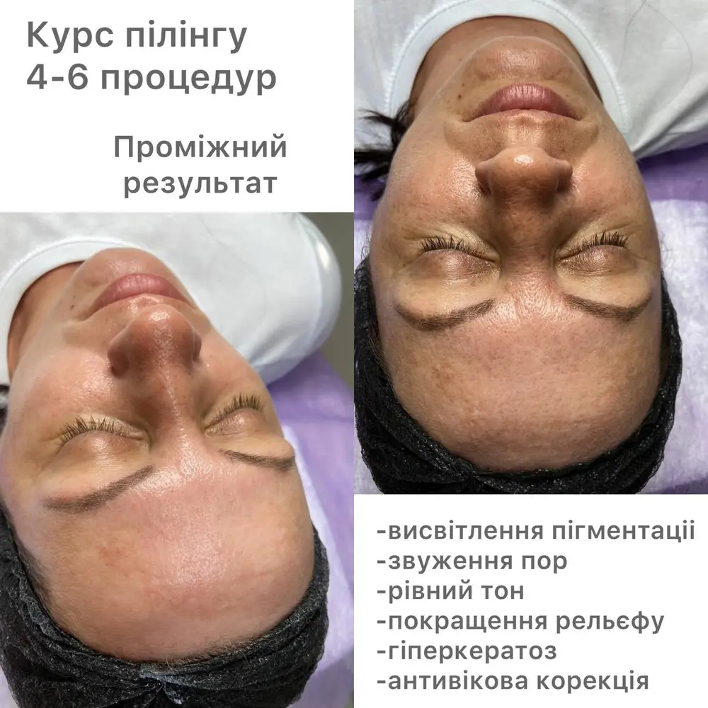 Студія Повітруля & Навчальний центр Регенерація photo 6