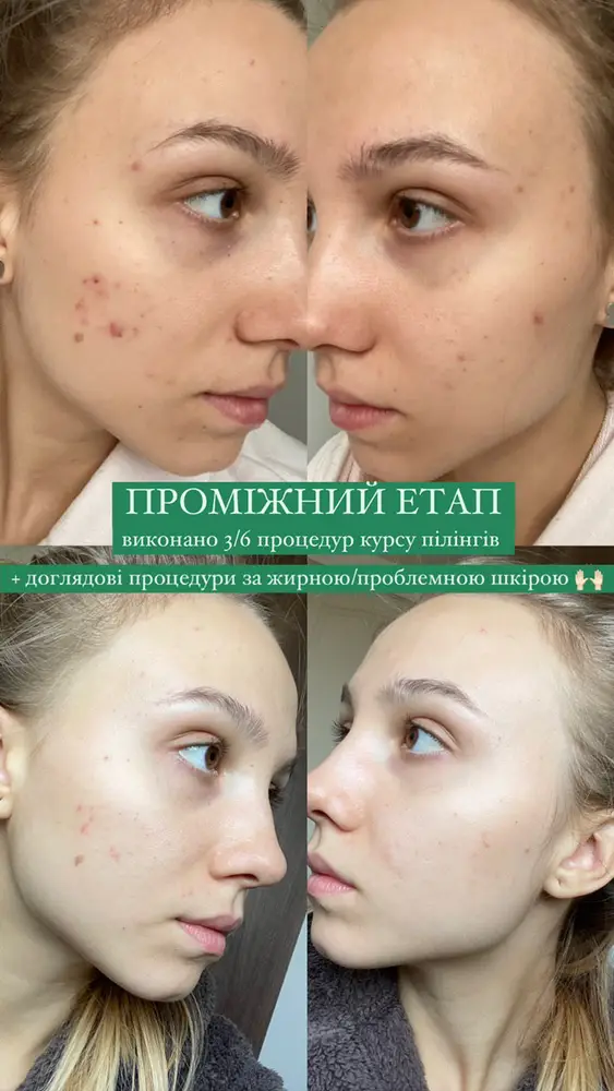 Студія Повітруля & Навчальний центр Регенерація photo 17