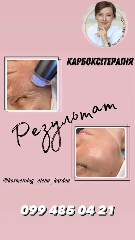 КАРДЕЯ photo 1