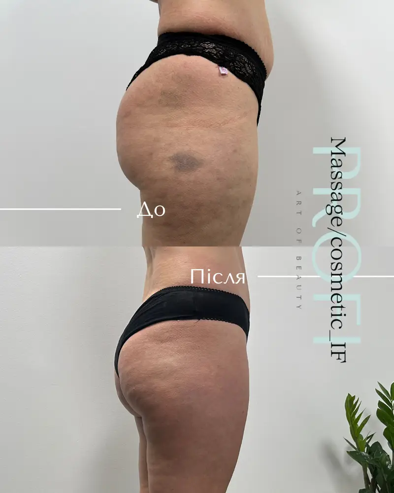 Profi_Massage/cosmetic_IF photo 2