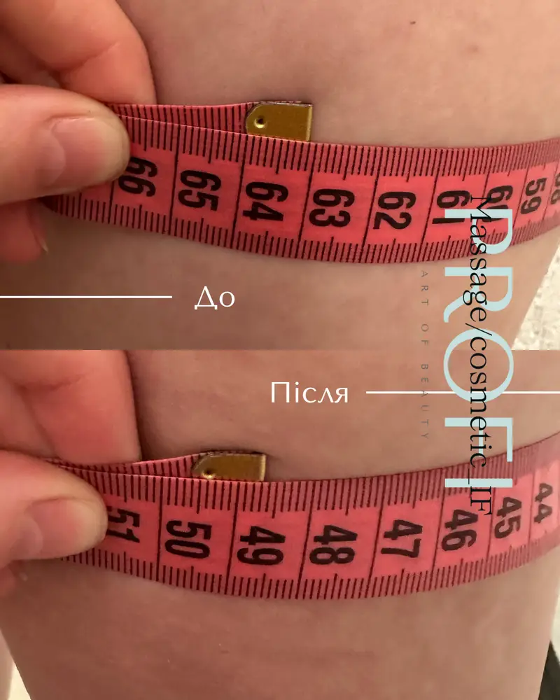 Profi_Massage/cosmetic_IF photo 3
