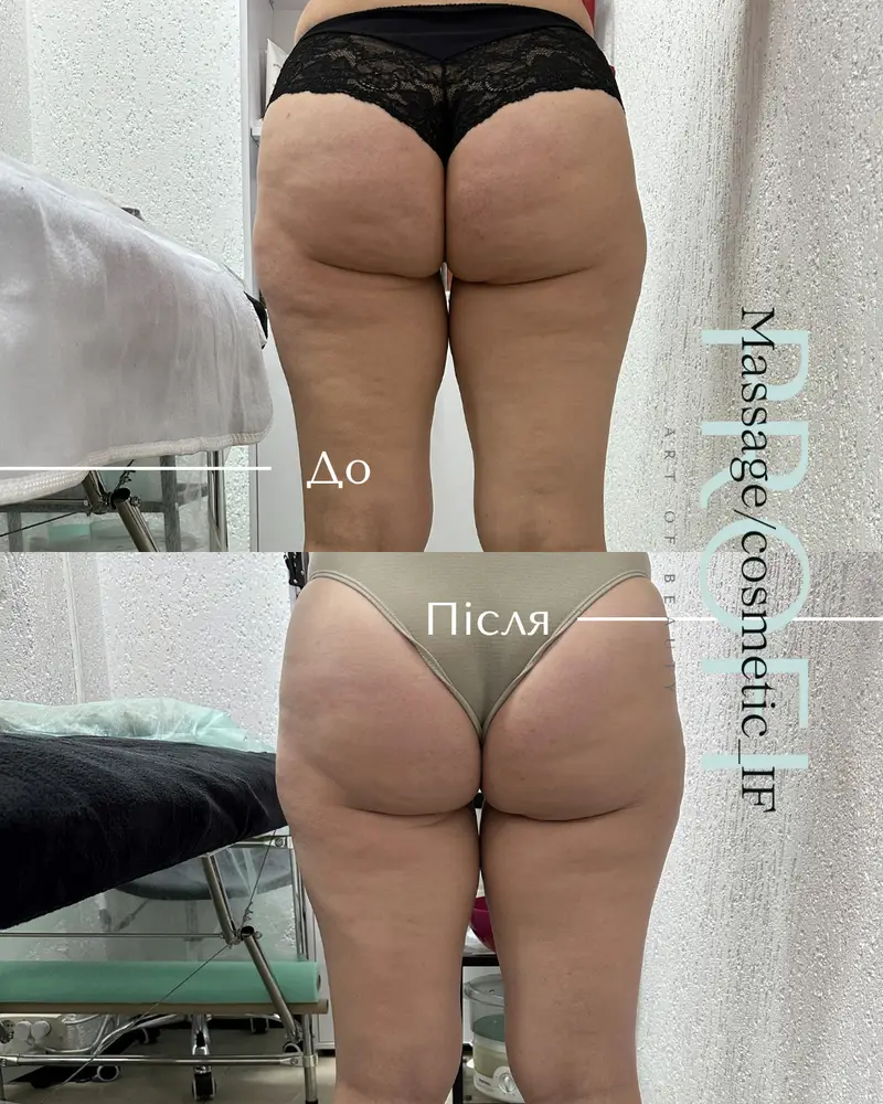 Profi_Massage/cosmetic_IF photo 5