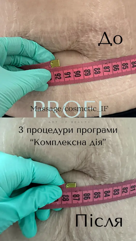 Profi_Massage/cosmetic_IF photo 7